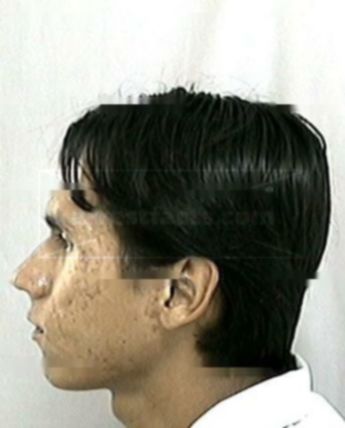 Jacob Thomas Arkeketa