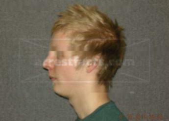 Carson A Bennett