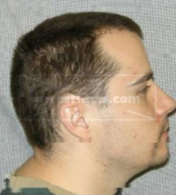 Anthony P Fleischman