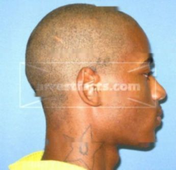Acarius C. Anderson