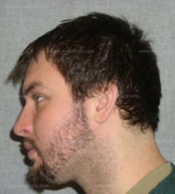 Christopher Burns