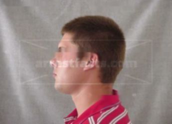 Michael S Brantmeier