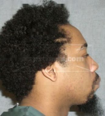 Terrence T Whitaker