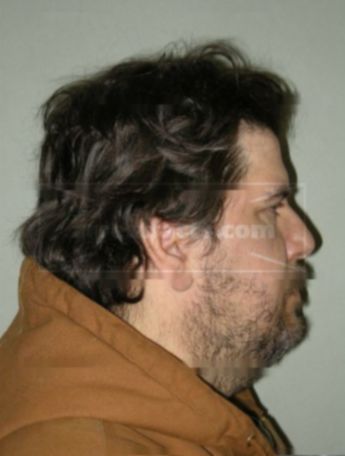 David L Bronk