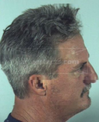 Keith Kinggard