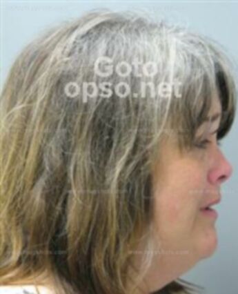 Lisa Lewis