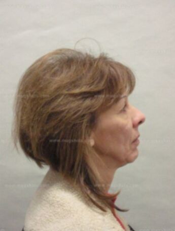Brenda L Rybarczyk