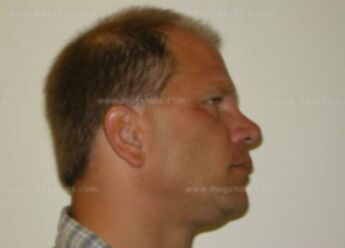 Randy A Kluck