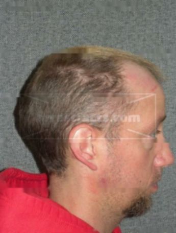 Shawn M Wettig
