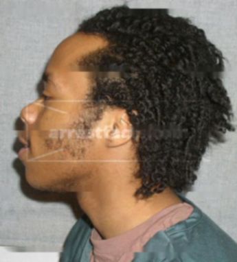 Dewhite Johnson