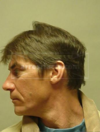 Michael P Brockmann