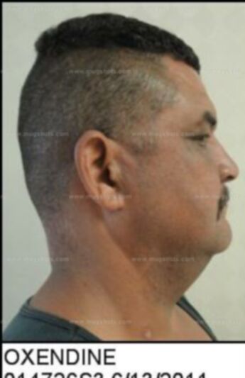 Tony Berig Oxendine