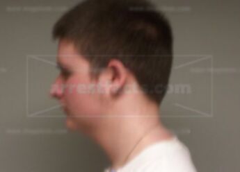 Austin L Wienke