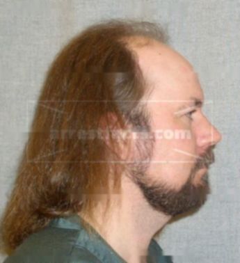 Dennis Pearson