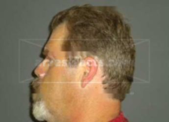 Todd Michael Volker