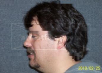Travis J Gurney