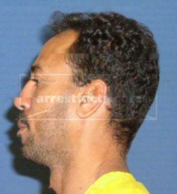 Luis R Colon