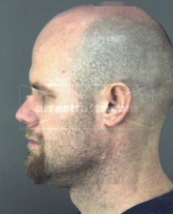 Dewey Preston Robinson