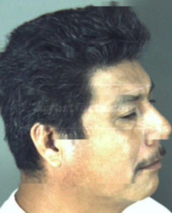 Ignacio Hernandez