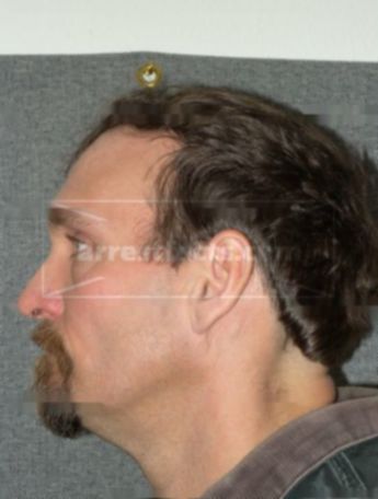 Donald P Hayes