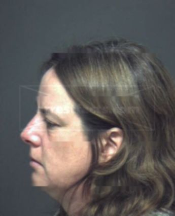 Denise A Kneller
