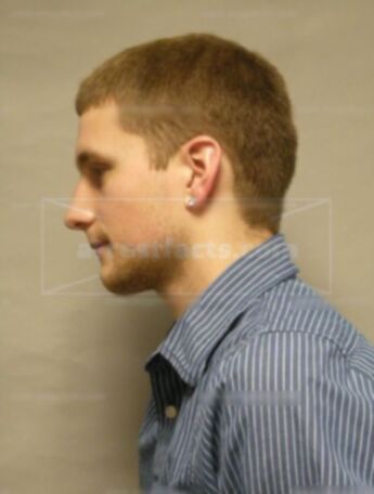 Justin P Case