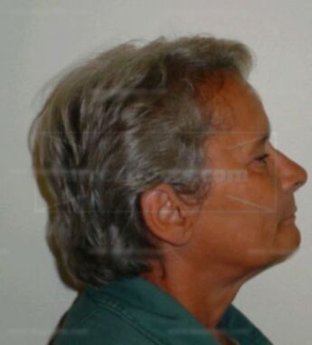 Ilda A Dumas