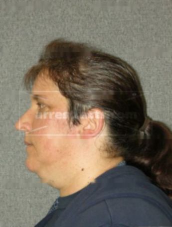 Janice M Klade