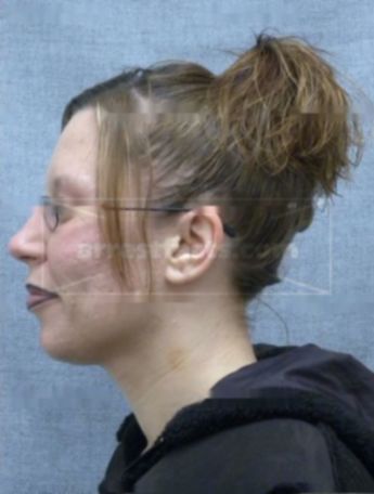 Shannon L Kloepfer
