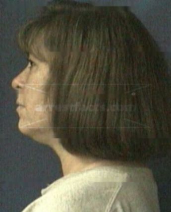 Sherry G Spechtenhauser