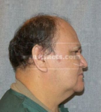 Jose L Torres-Rodriguez