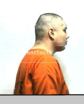 Sonny J Measles