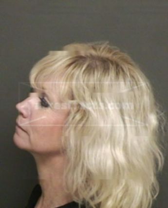 Rebecca Lices Brainard