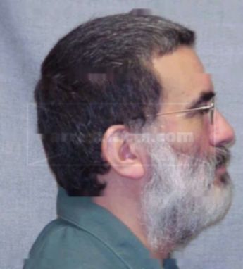 Patrick R Cantu