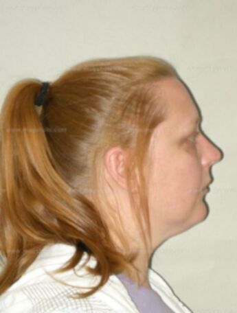 Jacqueline L Kamps