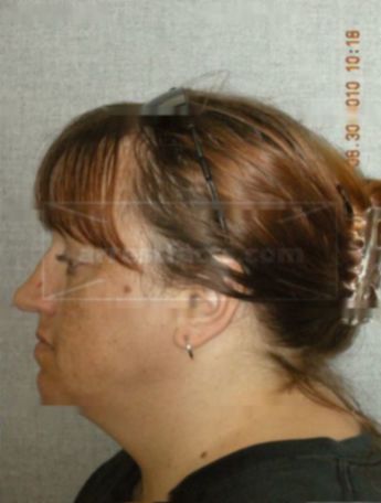 Sarah J Lehmann