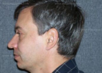 Jeffrey J Rau