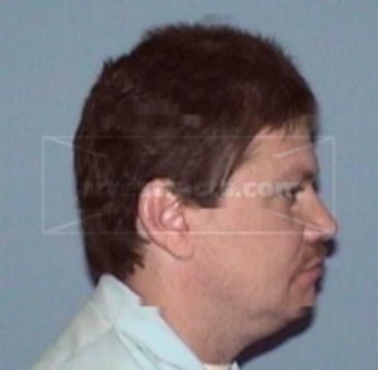 Gary W. Moushon