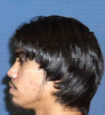 Emmanuel G Martinez