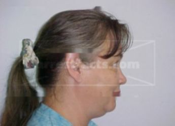Carolyn D Welch