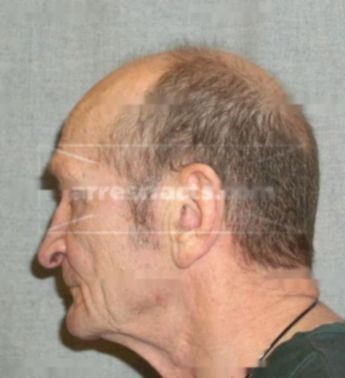 Kenneth Leon Bossingham