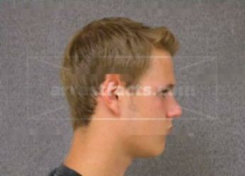 Derek M Ommen