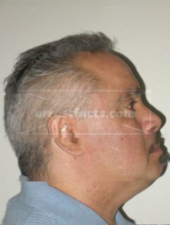 Carmelo R Silva