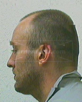 David L Barrett