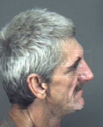 Thomas Mendel Glisson