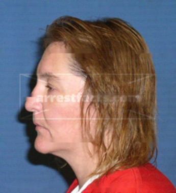 Wendy L Brycki