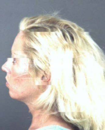 Amy Lynn Shaffer