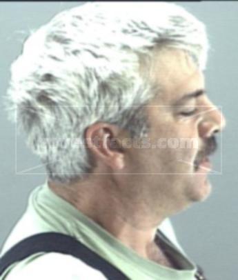 Anthony M Hanna