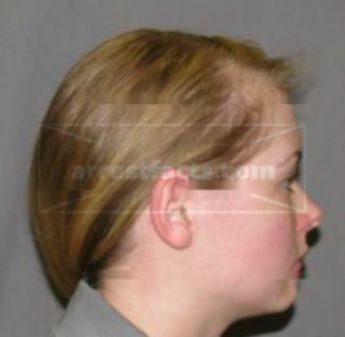 Allissa Michelle Wilhite