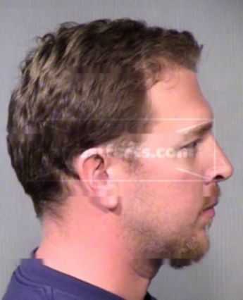Trent Allen Ritter